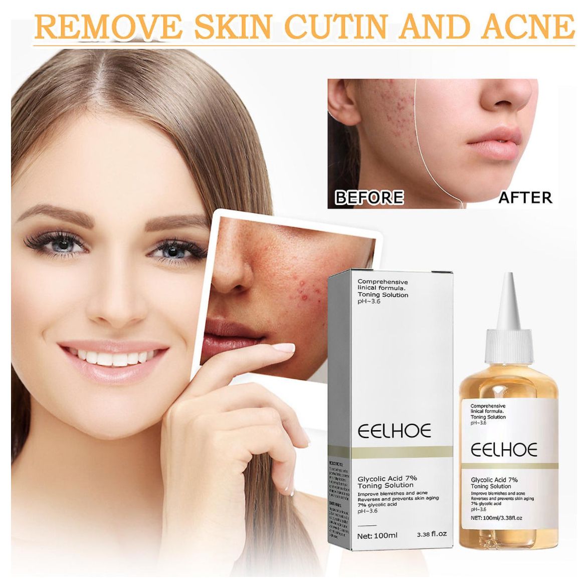 Eelhoe Glycolic Acid 7% Toning Solution