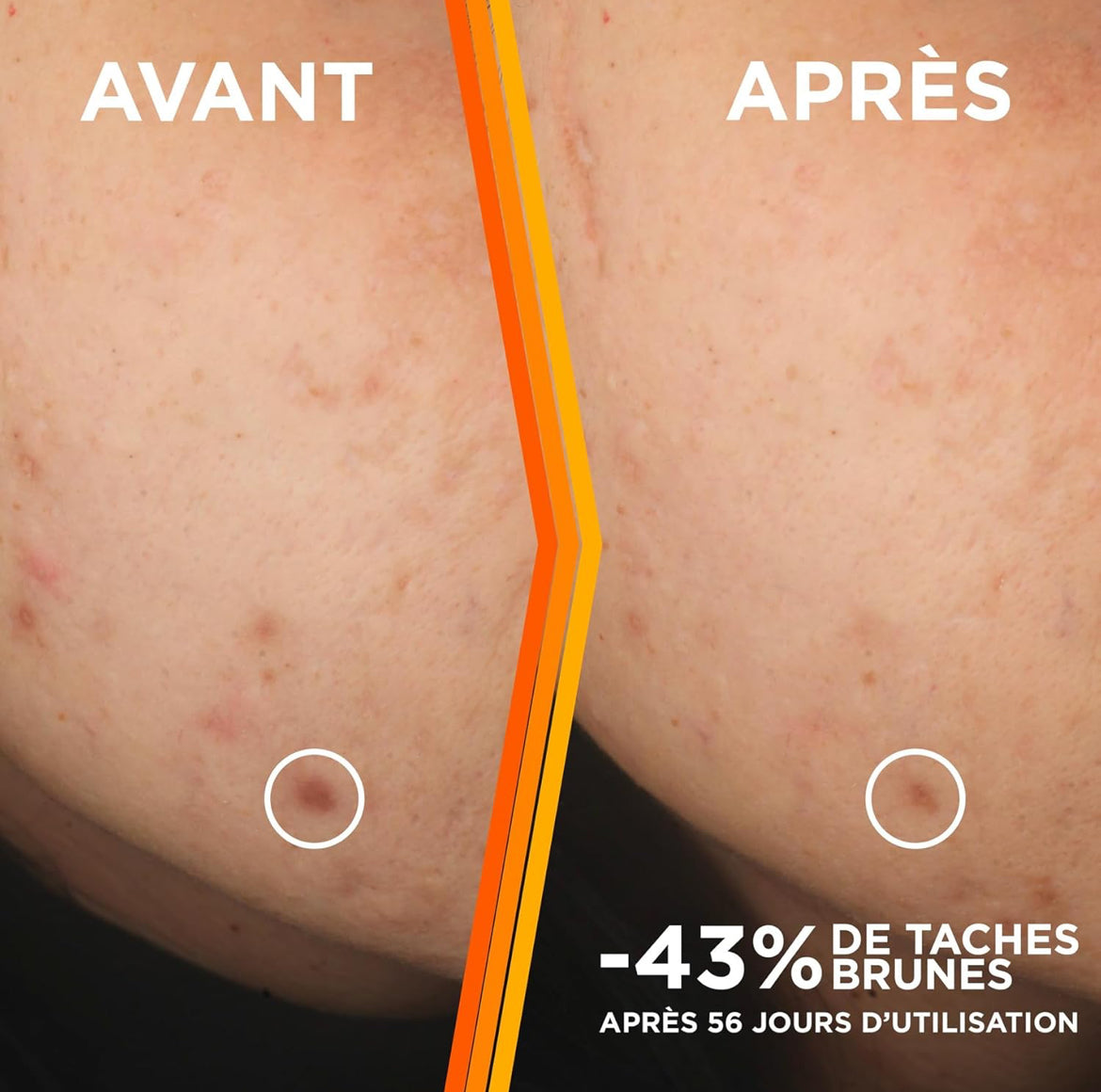 سيروم غارنييه سكين أكتيف المضاد للبقع الداكنة والمشرقة، غني بفيتامين سي وحمض الساليسيليك والنياسيناميد