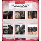 شامبو بيوكسين لعلاج تساقط الشعر الشديد - للنساء والرجال