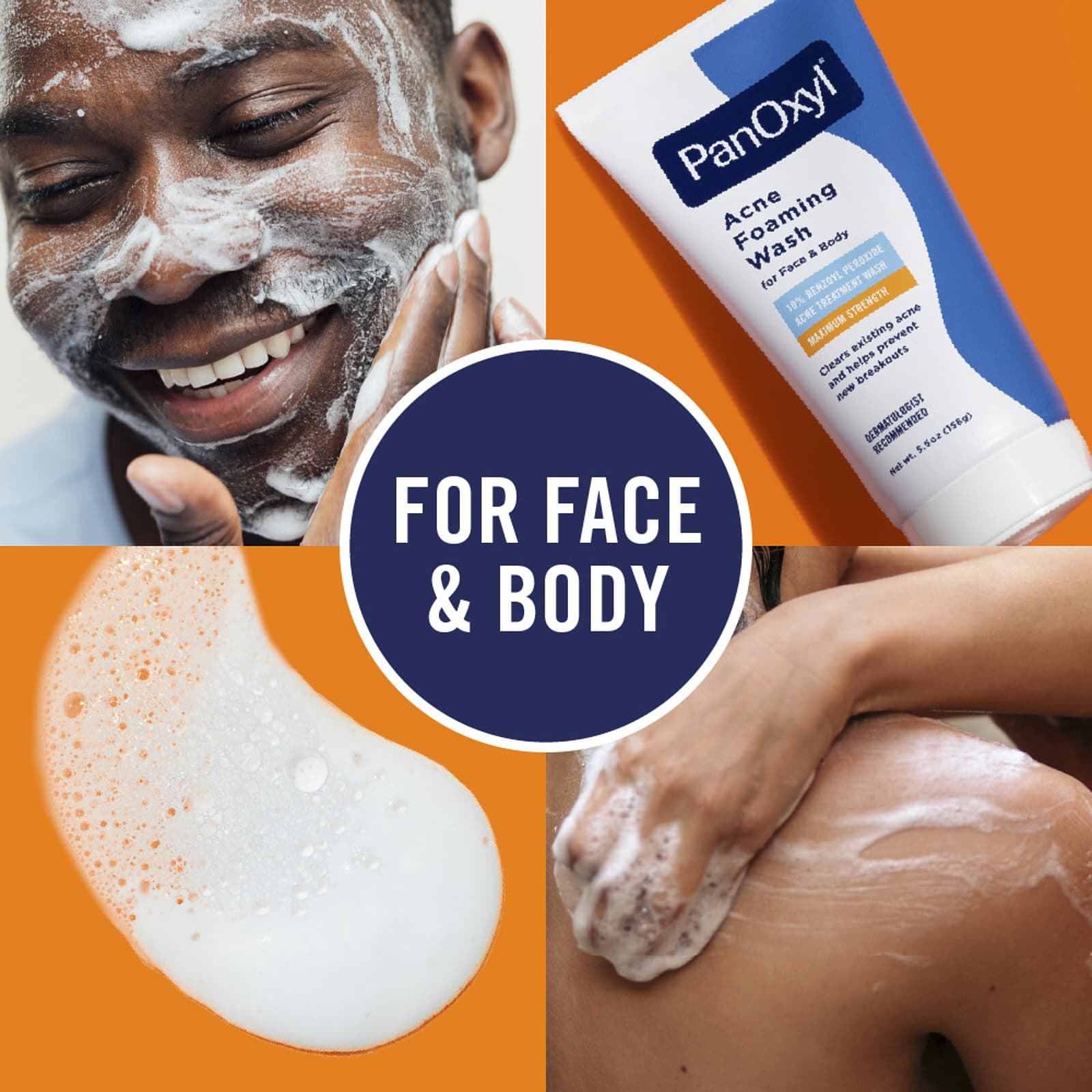 غسول بانوكسيل الرغوي لعلاج حب الشباب، بنزويل بيروكسيد 10%