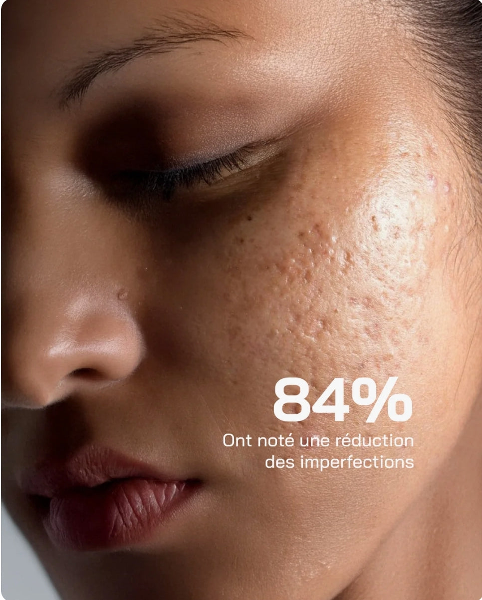 مصل حمض الساليسيليك Touché 10% مضاد للعيوب