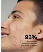 مصل حمض الساليسيليك Touché 10% مضاد للعيوب