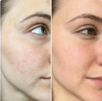 Touché Sérum Acide Glycolique 8% +Aloe Vera Lotion Tonique Purlflante