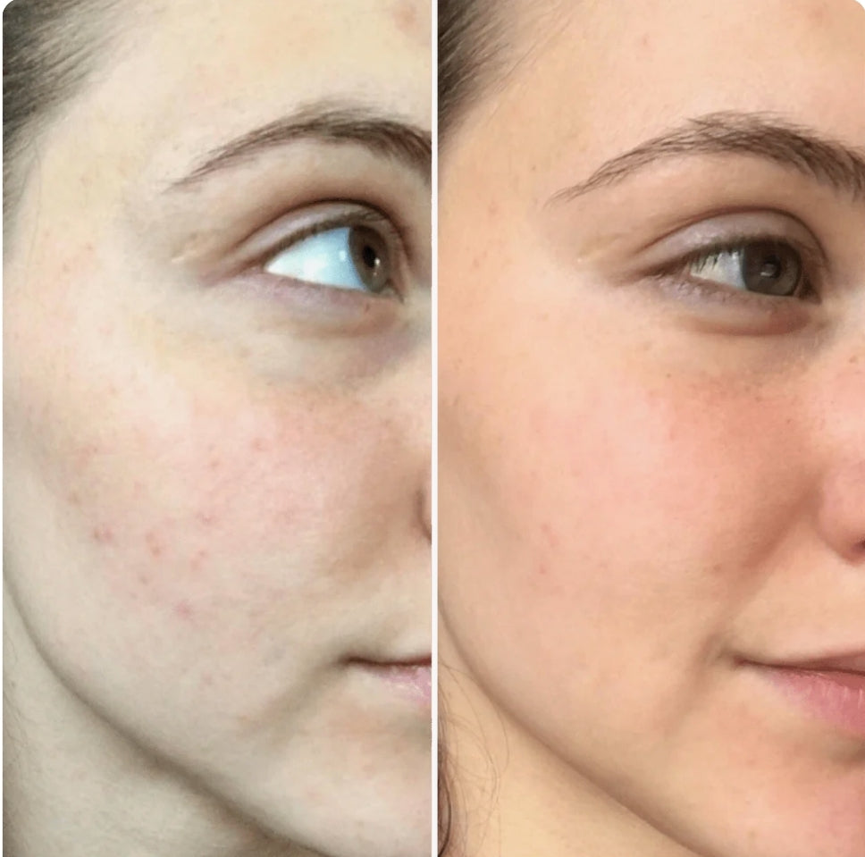 Touché Sérum Acide Glycolique 8% +Aloe Vera Lotion Tonique Purlflante