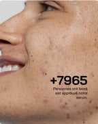 Touché Sérum Anti Acné